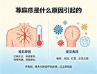 荨麻疹是什么原因引起的